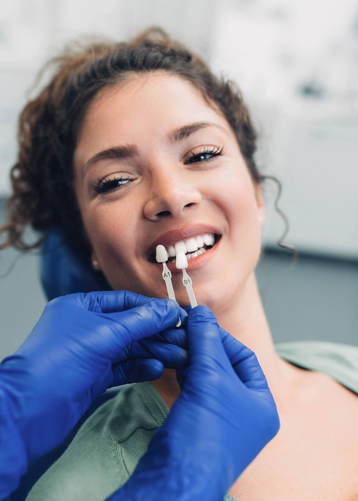 Crown for Anterior Teeth