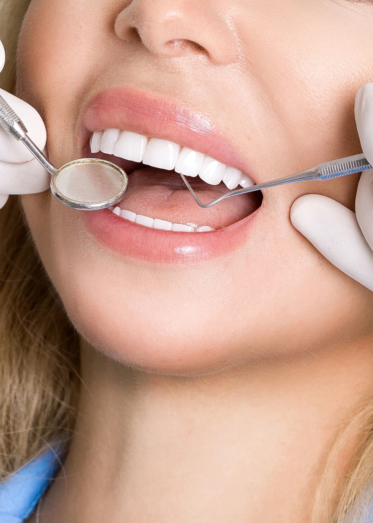 Periodontal Cleaning