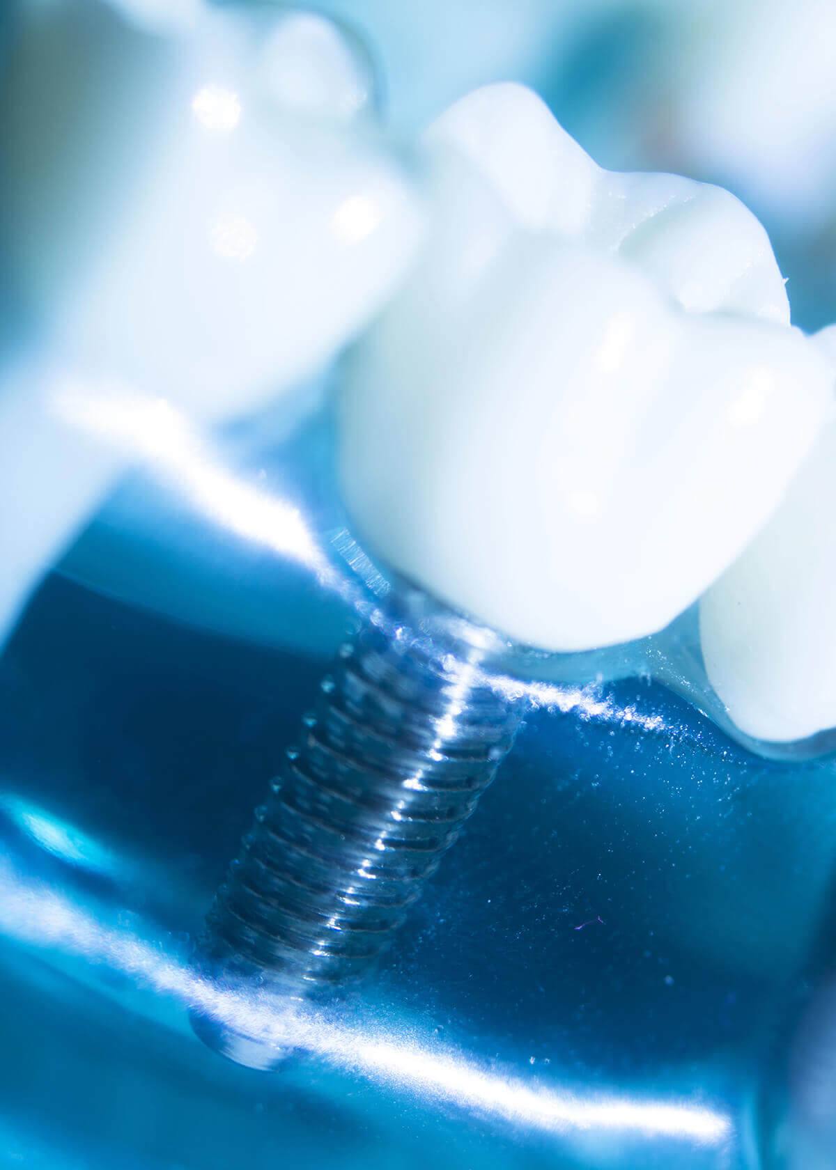 Cosmetic and Restorative Dentistry