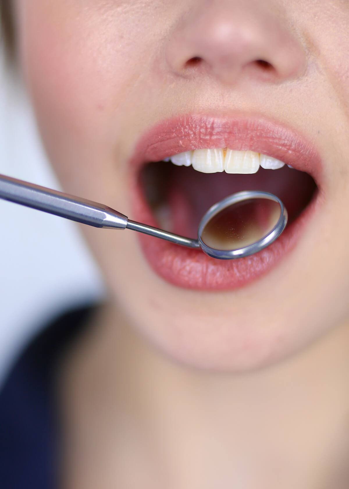 Oral Cancer Cleaning